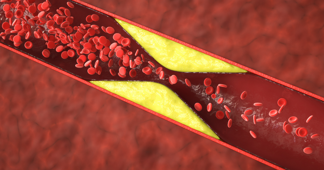 Cholesterol and Glucose Levels: What’s the Connection?
